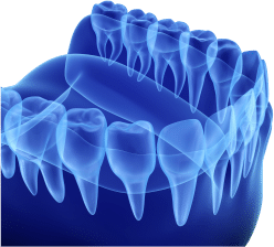 3D Dental Model
