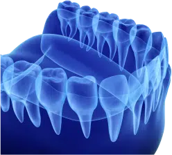 Cone Beam And 3D Scan Model